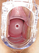 Schamlappen, Large Labia and Vagina Picture from ITC
